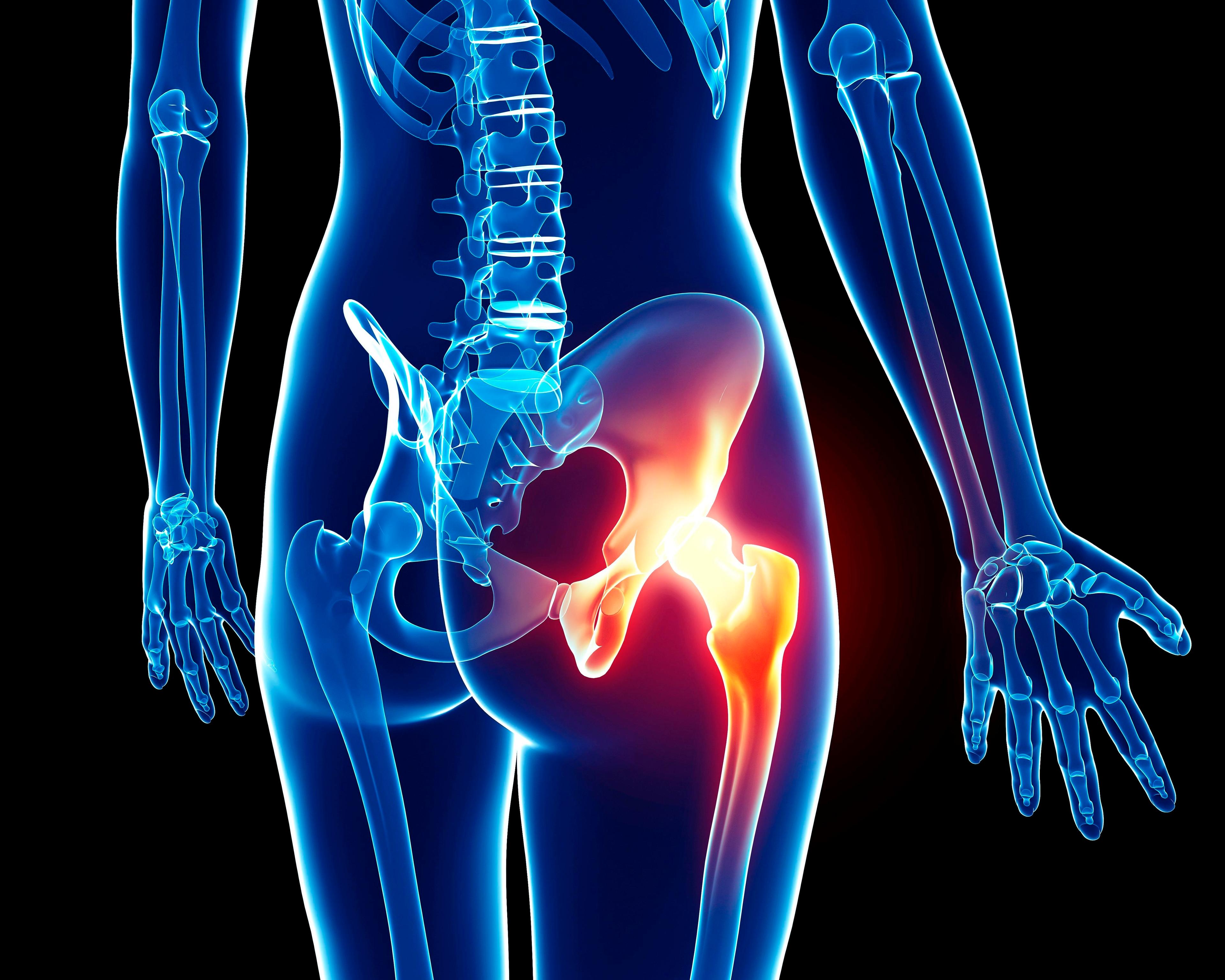 Hip pain-530305146.jpg